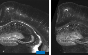 Images of a mouse brain segment enlarged